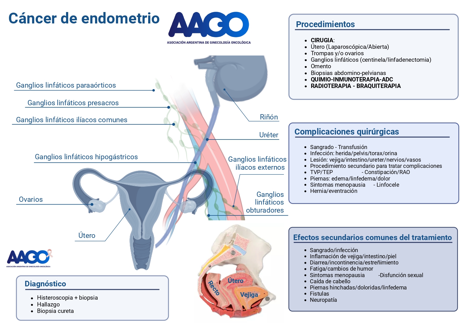 Cáncer de Endometrio