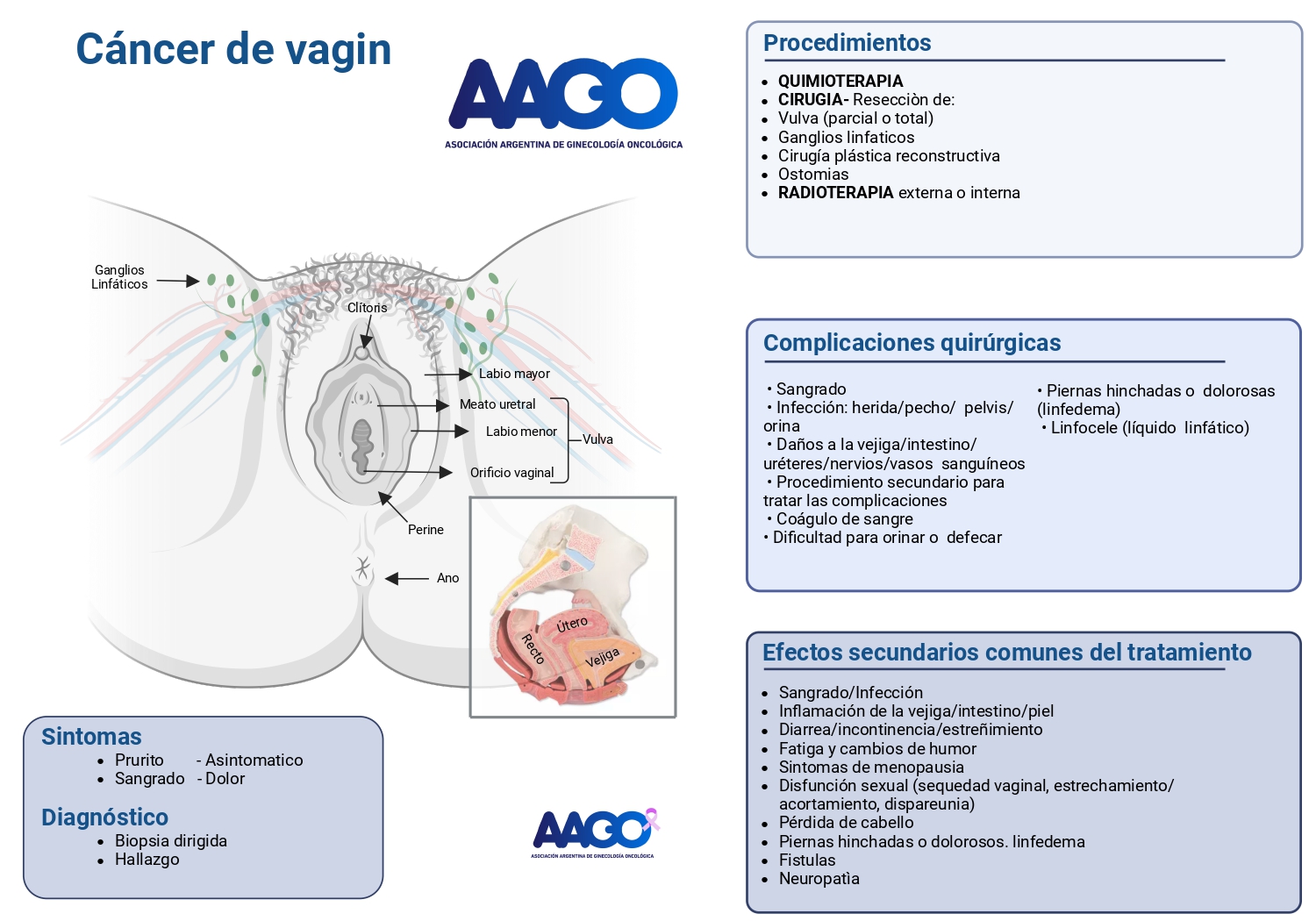 Cáncer de Vagina
